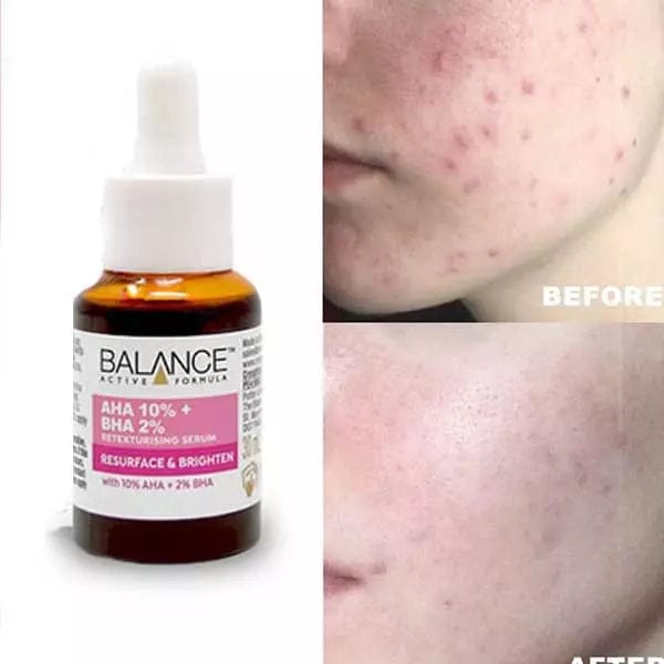 Balance Active Formula AHA 10% + BHA 2% Serum – Resurface & Brighten Solution | Exfoliating Face Serum for Smooth, Clear & Radiant Skin JZCosmetics.com