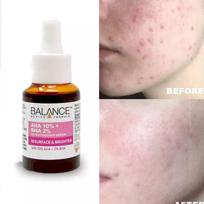 Balance Active Formula AHA 10% + BHA 2% Serum – Resurface & Brighten Solution | Exfoliating Face Serum for Smooth, Clear & Radiant Skin JZCosmetics.com