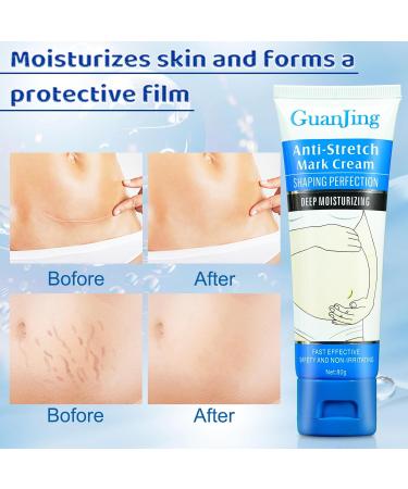 Guanjing Anti Stretch Mark Cream JZCosmetics.com