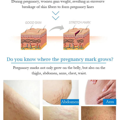 Guanjing Anti Stretch Mark Cream JZCosmetics.com