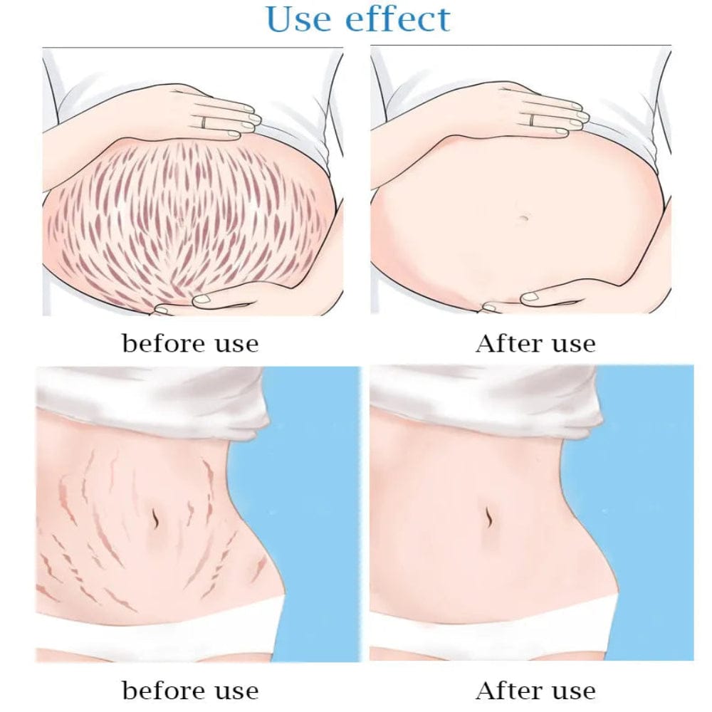 Guanjing Anti Stretch Mark Cream JZCosmetics.com