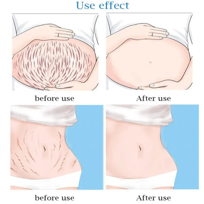 Guanjing Anti Stretch Mark Cream JZCosmetics.com