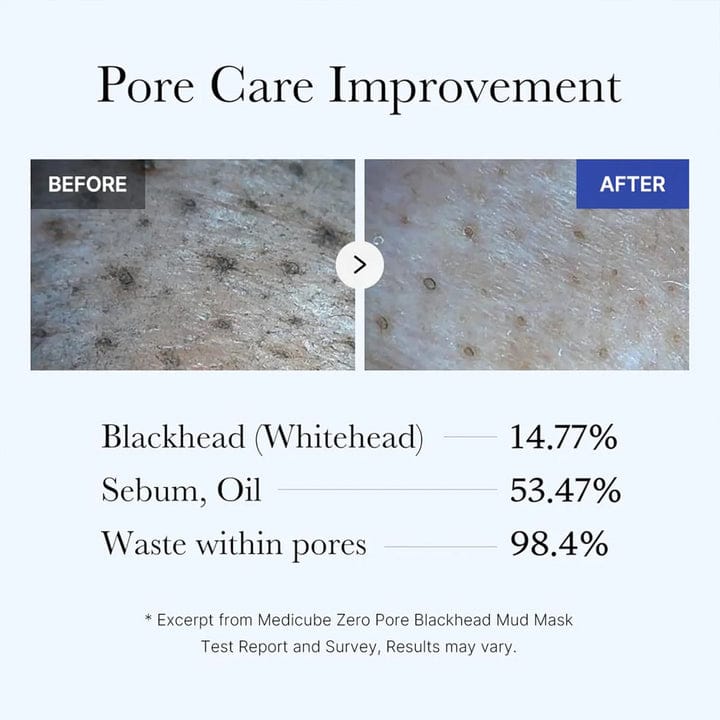 Medicube Zero Pore Blackhead Mud Mask 100g JZCosmetics.com
