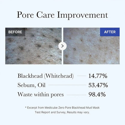 Medicube Zero Pore Blackhead Mud Mask 100g JZCosmetics.com