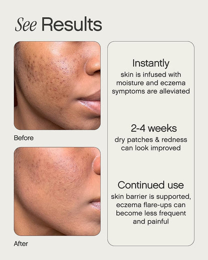 Topicals Like Butter Moisturizer | Hydrating Cream for Dry, Sensitive & Eczema-Prone Skin | Soothing, Nourishing & Redness-Reducing Formula JZCosmetics.com