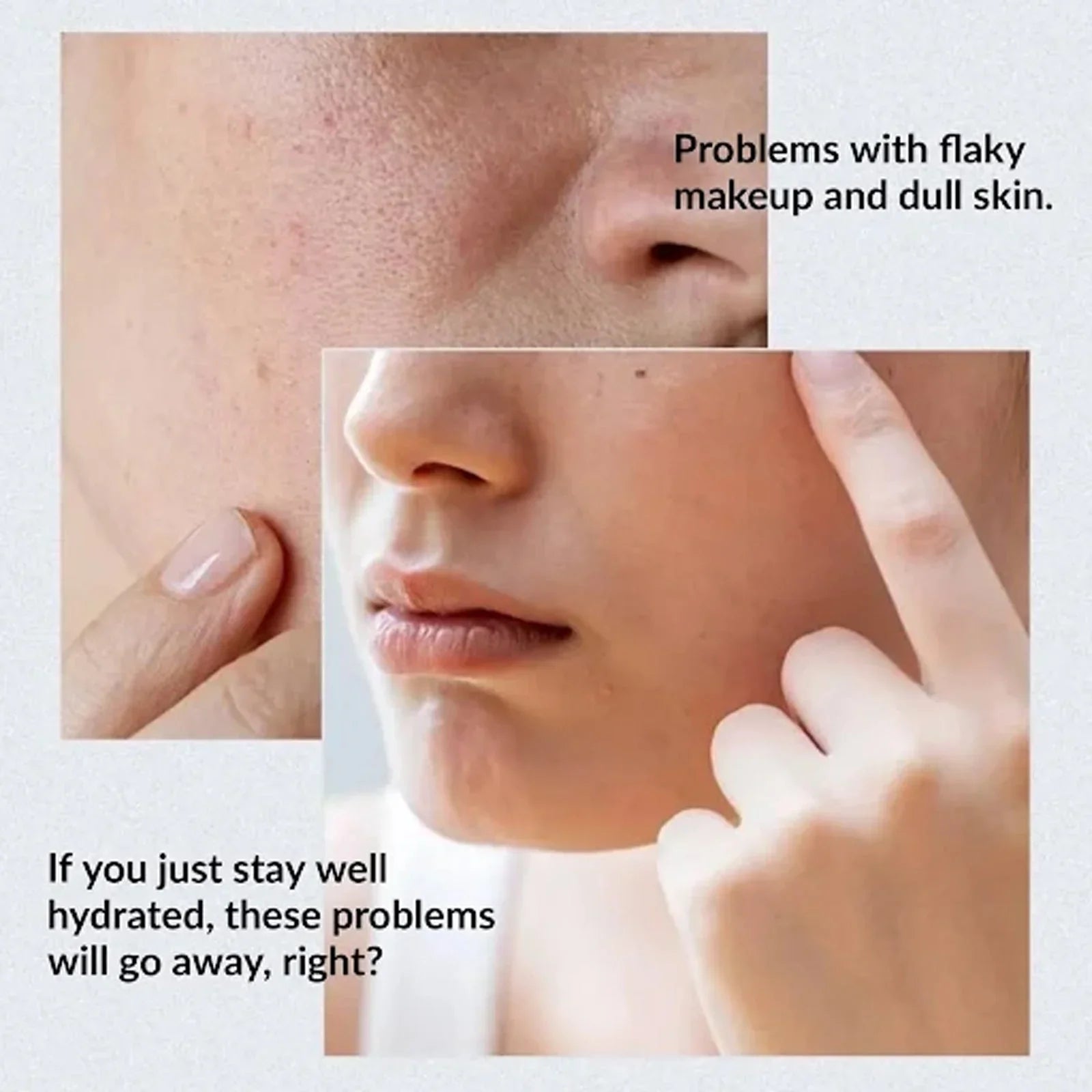 ANUA Birch 70% Moisture Boosting Serum | Deep Hydration & Skin Barrier Care | Lightweight Soothing Formula JZCosmetics.com