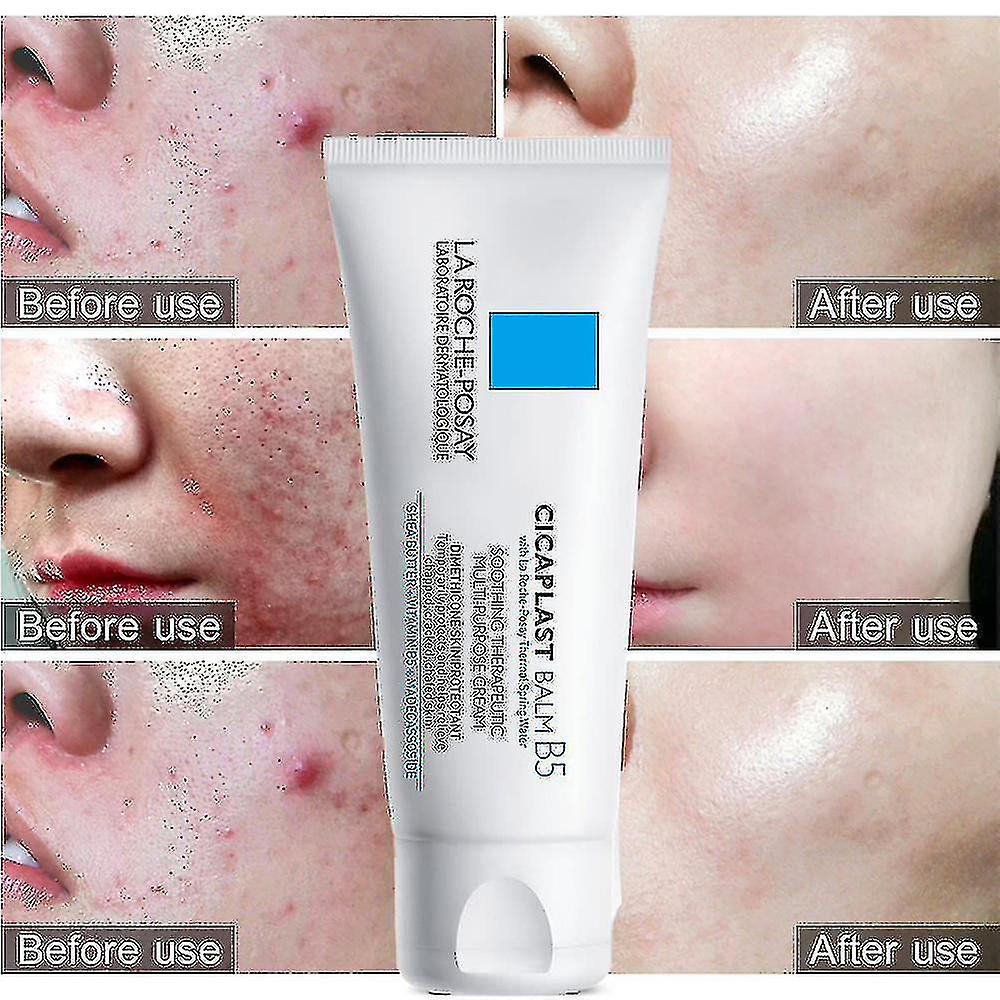 La Roche-Posay Cicaplast Balm B5+ 100ml | Skin Barrier Repair Cream | Soothing & Hydrating Balm | Made in France JZ Cosmetics