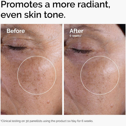 Glycolic Acid 7% Exfoliating Toning Solution 240ml | Skin Smoothing, Brightening & Radiance Boosting Toner JZ Cosmetics