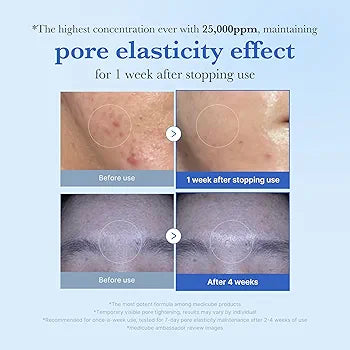 MEDICUBE One Day Exosome Shot Pore Ampoule 25000 – 13ml | Tight Pores • Smooth Texture • Fast Absorption • Korean Skincare
