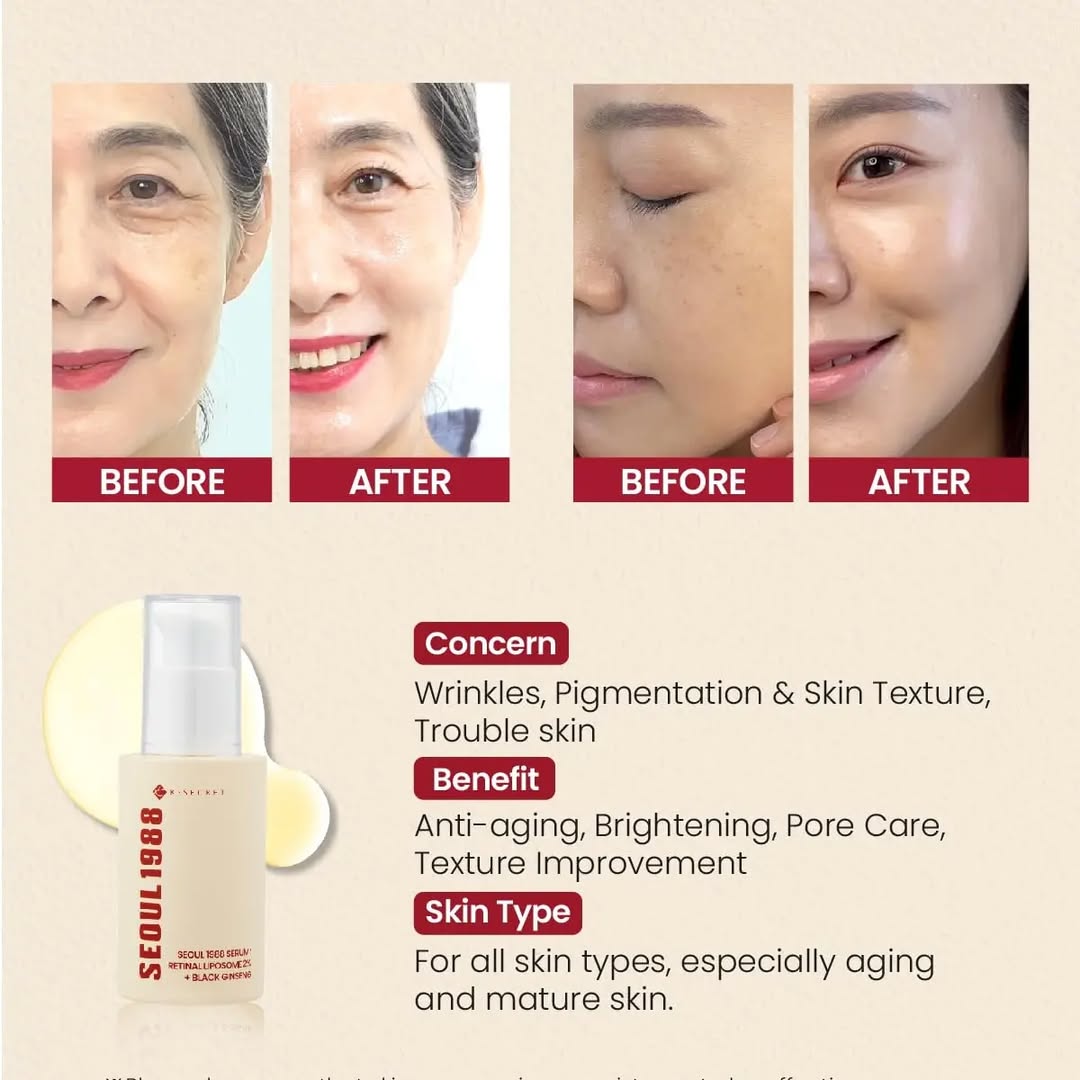 K-Secret Seoul 1988 Retinol & Black Ginseng Serum 30ml | Anti-Aging, Firming & Brightening Face Serum | Made in Korea JZ Cosmetics