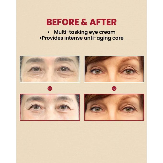 K-Secret Seoul 1988 Eye Cream 30ml | Retinal Liposome 4 + Fermented Bean JZ Cosmetics