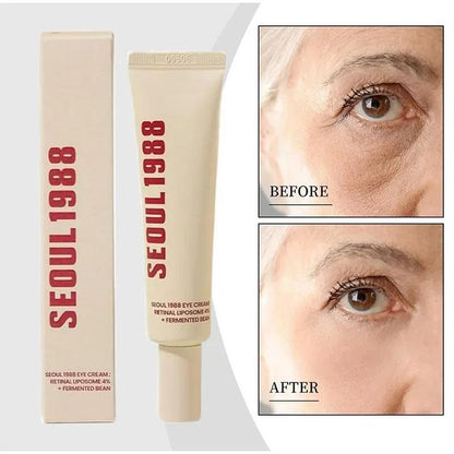 K-Secret Seoul 1988 Eye Cream 30ml | Retinal Liposome 4 + Fermented Bean JZ Cosmetics
